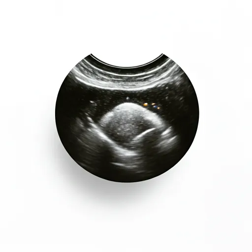 Standard 4D ultrasound result — grainy and low detail