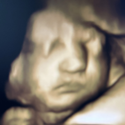 Original ultrasound 2