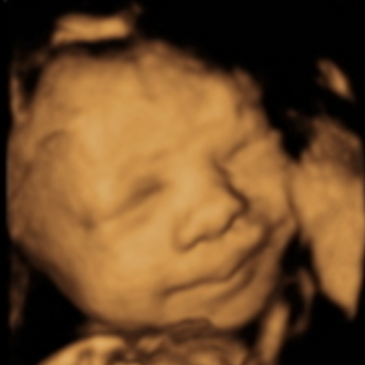 Original ultrasound 1