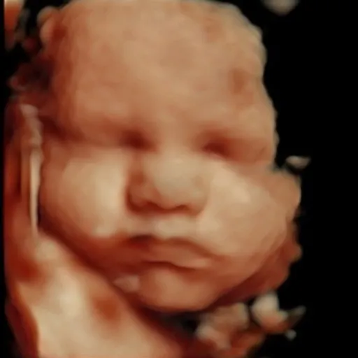 Original ultrasound during consultation