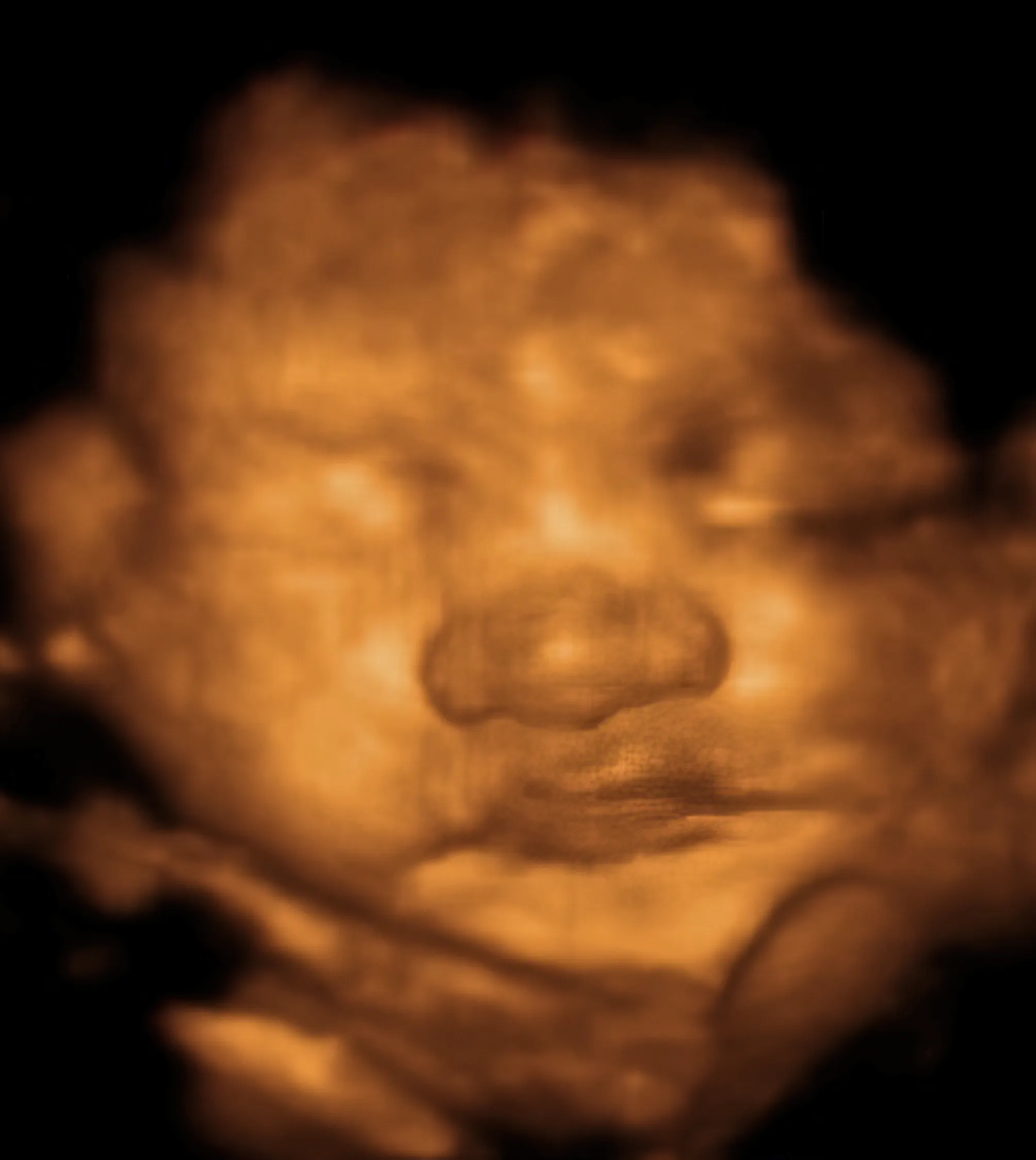 8K realistic baby ultrasound keepsake