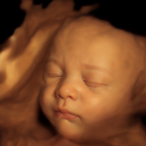 Ultrasound 6D